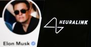 Neuralink ma rozwiązać problem otyłości. Musk szuka pracowników