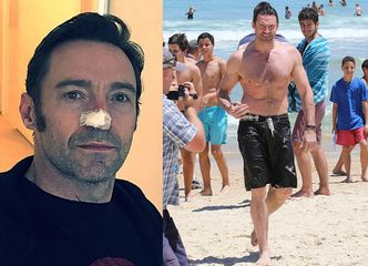 Hugh Jackman: "Znowu usunięto mi komórki nowotworowe"