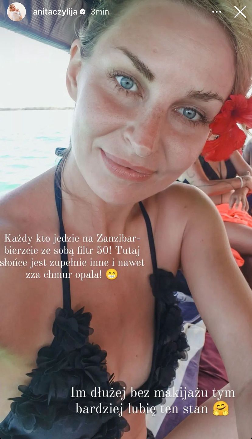 Anita bez makijażu