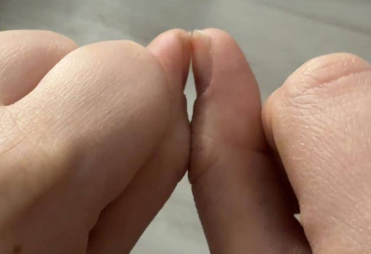 "Test palca". Zajmuje pięć sekund, a może pomóc w diagnozie raka