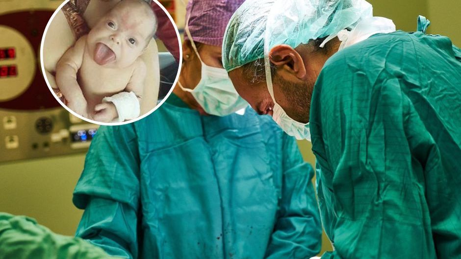 Urodziła się z ogromnym językiem. Dziewczynka nie była w stanie samodzielnie oddychać