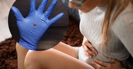 Nowotwór, który przez lata rozwija się bezobjawowo. Tak wygląda