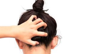 Swędząca skóra głowy – przyczyny i sposoby walki z dolegliwością