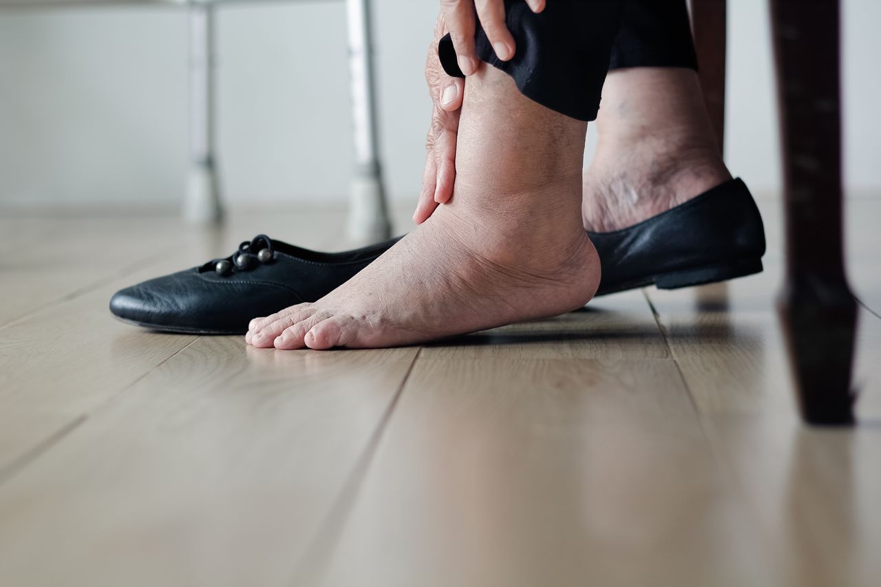 Jak radzić sobie z opuchniętymi stopami latem?