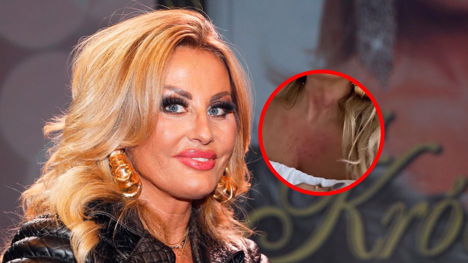 Dagmara Kaźmierska poddała się zabiegom medycyny estetycznej