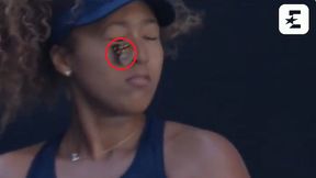 Owad nie chciał się odczepić. Niecodzienne problemy Naomi Osaki [WIDEO]
