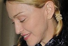 Co się stało z twarzą Madonny?!