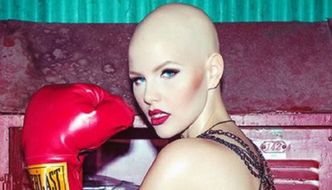 Chora na raka modelka: "Każda kobieta może być piękna"