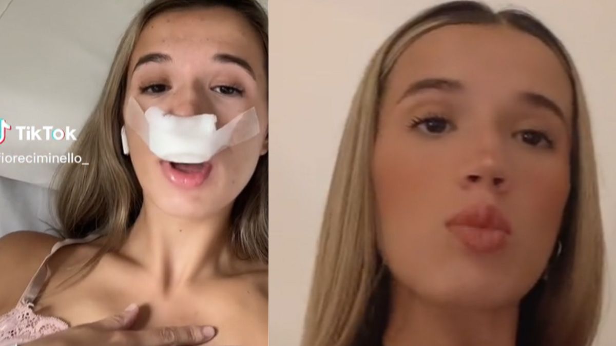 Zrobiła korektę nosa. Chce by jej dzieci odziedziczyły jego nowy kształt