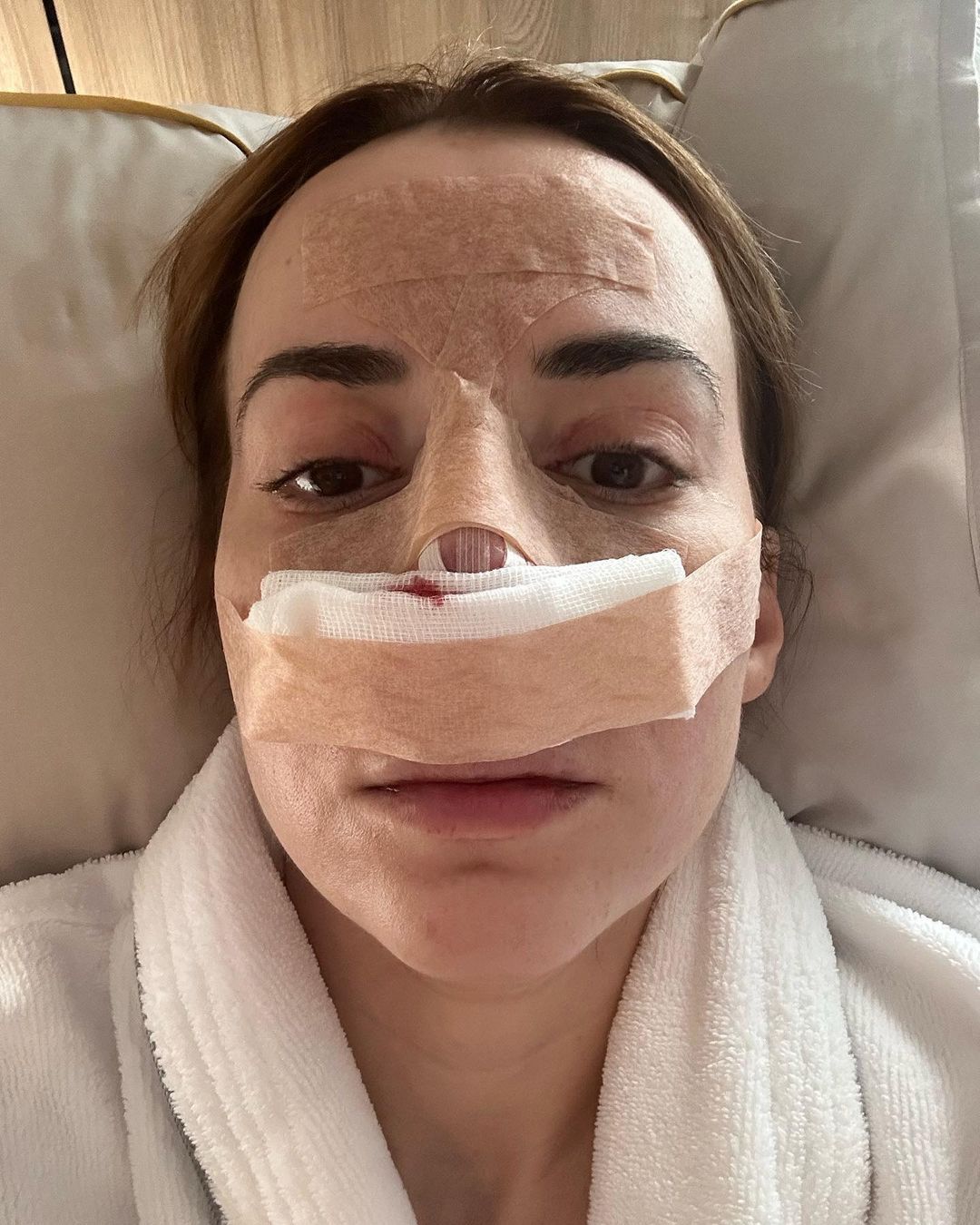 Marianna Schreiber po operacji nosa