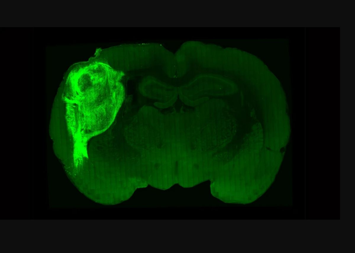  Miniaturowe ludzkie mózgi wszczepione szczurom