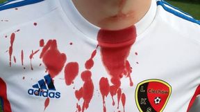 Horror w polskiej lidze. Kibol chciał piłkarzowi poderżnąć gardło