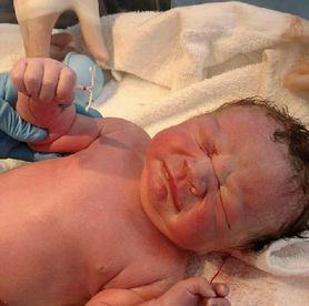Niezwykłe narodziny: dziecko trzymało w rączce spiralę