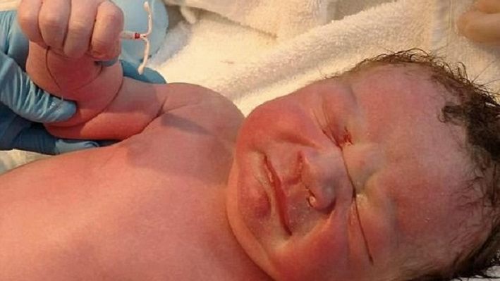 Niezwykłe narodziny: dziecko trzymało w rączce spiralę