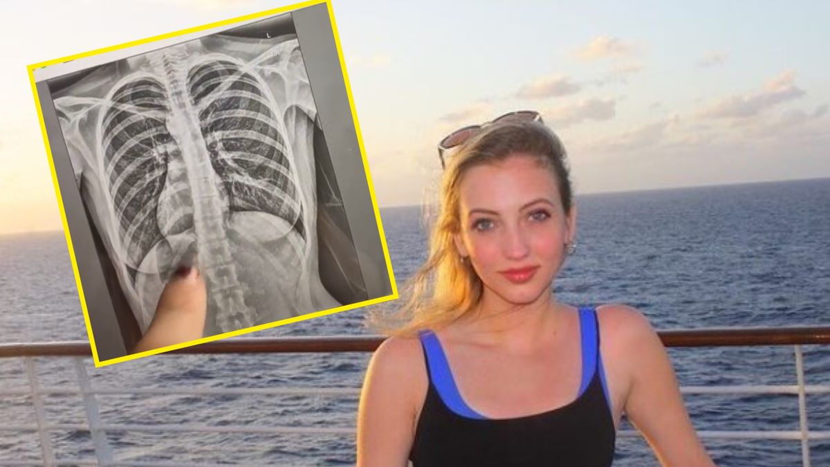 19-latka z Chicago nie mogła uwierzyć w to, co powiedział jej lekarz 