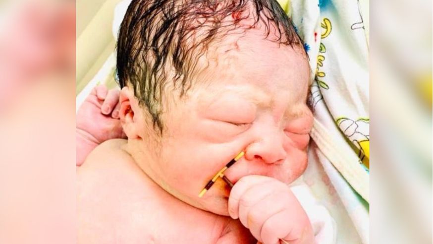 Nie planowała ciąży. Dziecko urodziło się z antykoncepcją w rączce