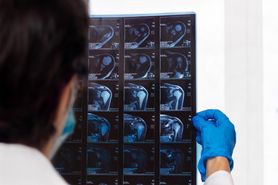 Rezonans magnetyczny barku – przebieg, wskazania i przygotowanie