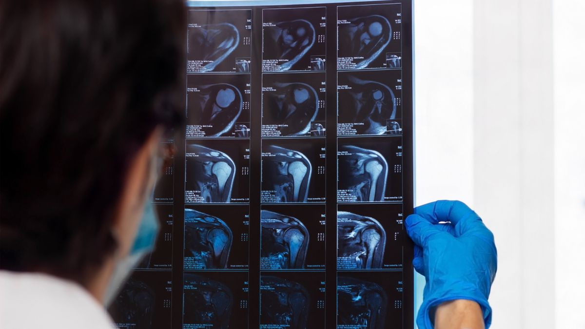 Rezonans magnetyczny barku to procedura dość kosztowna