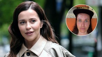 Malwina Wędzikowska miała wypadek na wakacjach. Z czoła polała się krew