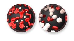 Nietypowe objawy białaczki