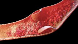 Przeciwciała ANCA - charakterystyka, badania, normy i interpretacja