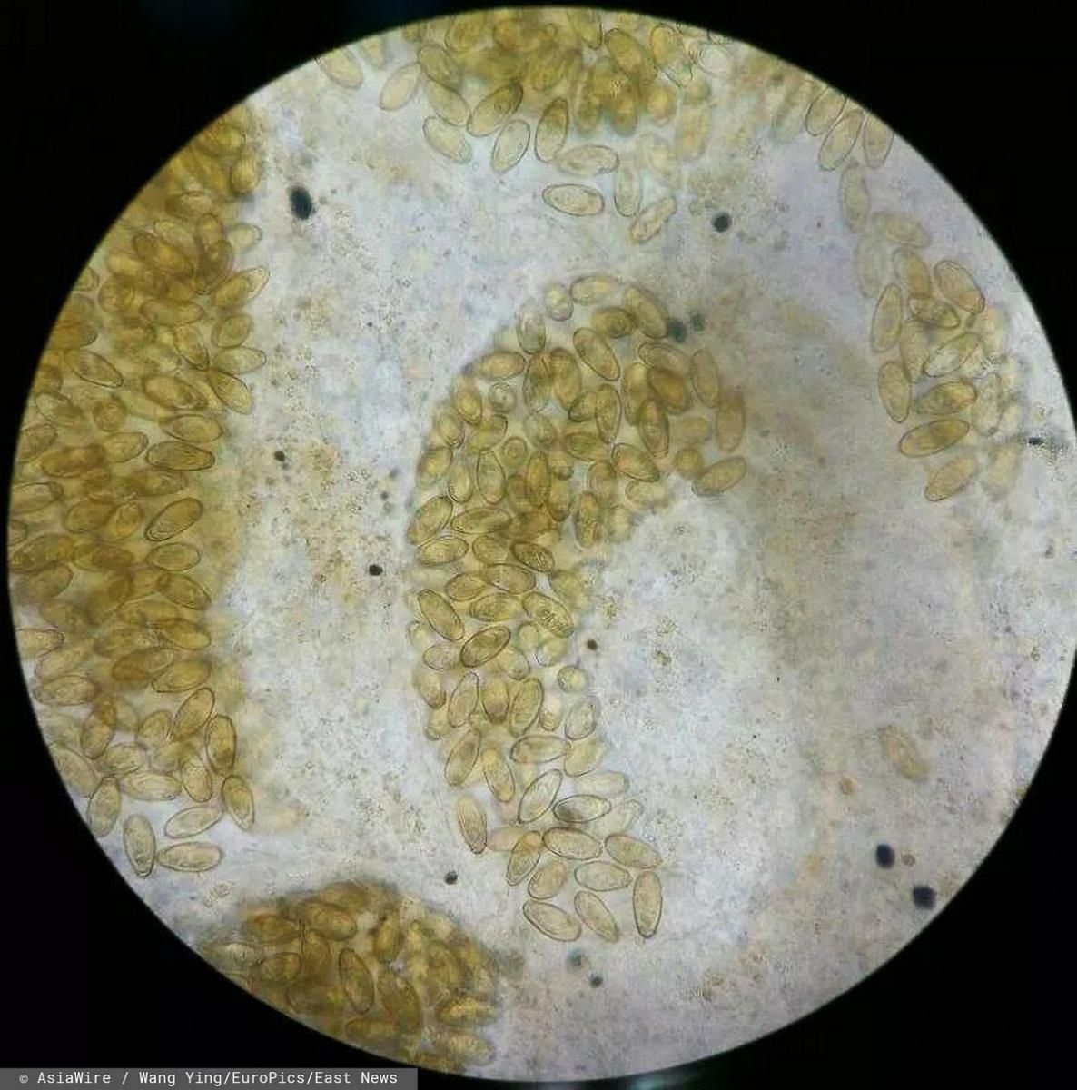 Jaja pasożyty na wątrobie