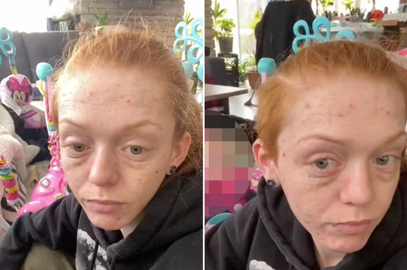 Kendra za swój wygląd obwinia córkę