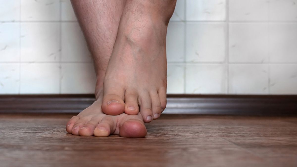 Chromanie to tępy ból nóg w czasie aktywności fizycznej.