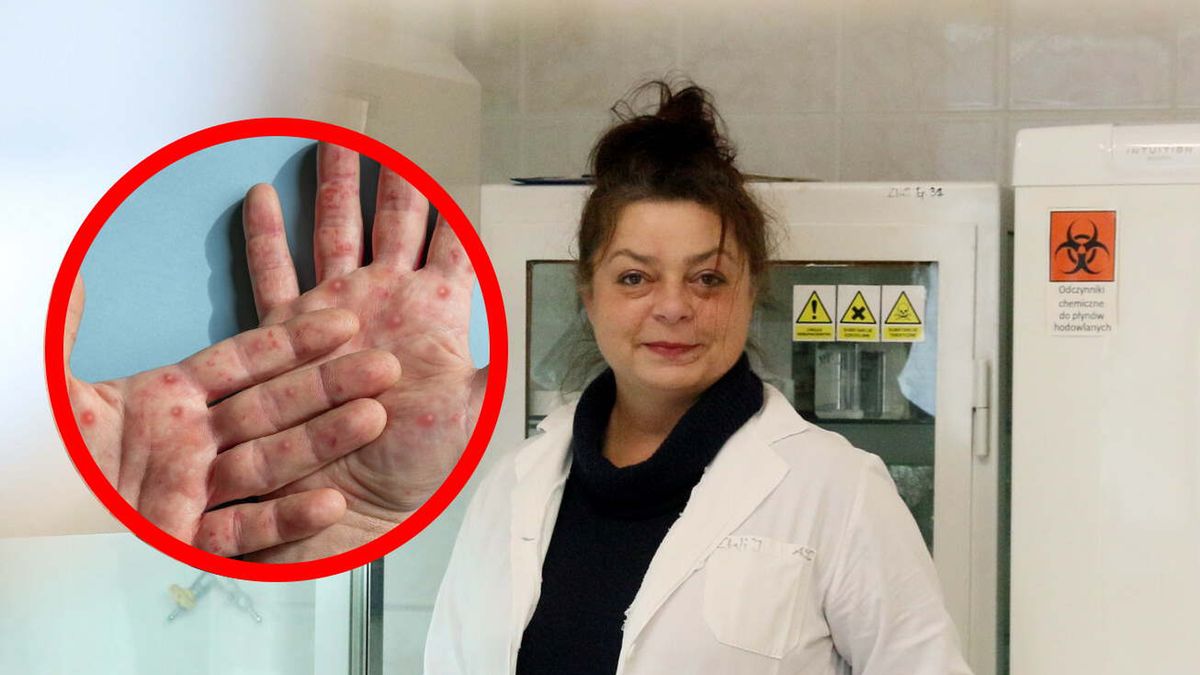 Wirus jest już w Europie. Prof. Szuster-Ciesielska: Mam nadzieję, że Polska wkrótce wyda wytyczne