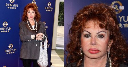 Mama Stallone'a wciąż się operuje! (ZDJĘCIA)