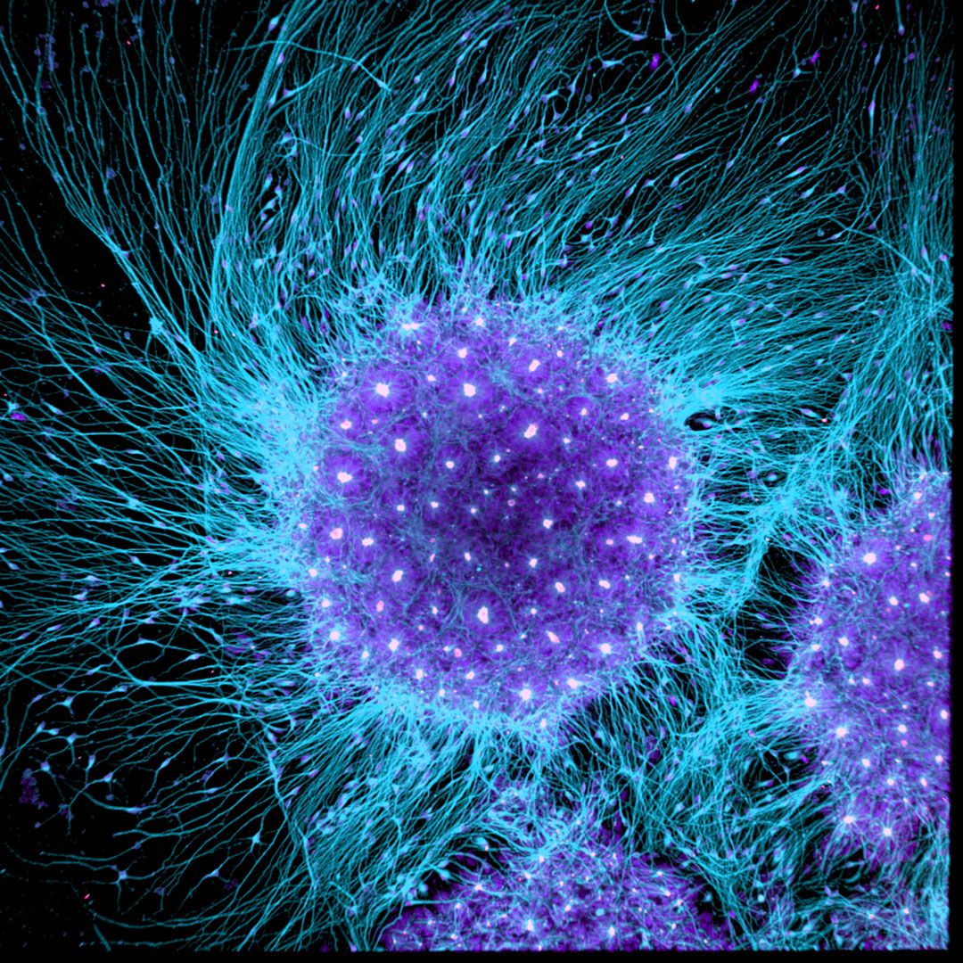 Wspaniały świat z bliska, czyli finaliści Nikon’s Small World 2016. Polacy wśród wyróżnionych 9