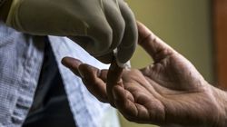 Stłuszczenie wątroby prowadzi do cukrzycy. Naukowcy odkryli, jak wpłynąć na poziom insuliny we krwi