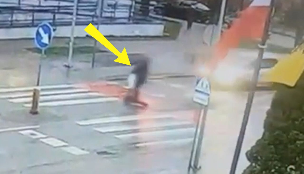 Boli od samego patrzenia. 15-latek jechał hulajnogą. Dramatyczny finał