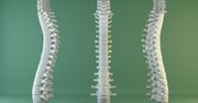 Operacja złamania kręgu - przyczyny, objawy, diagnostyka