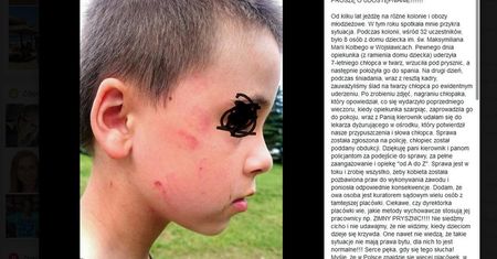 Chłopiec z domu dziecka uderzony przez opiekunkę. To nie był pierwszy raz?