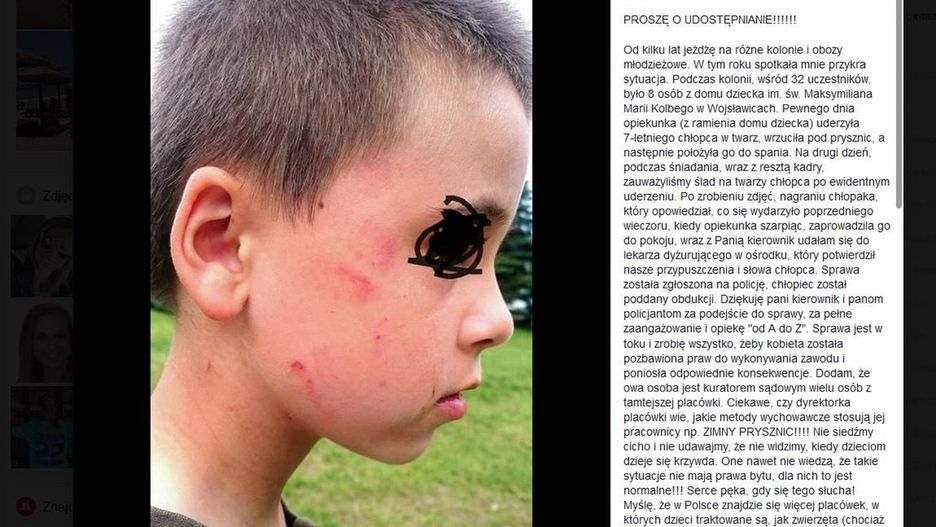 Chłopiec z domu dziecka uderzony przez opiekunkę. To nie był pierwszy raz?