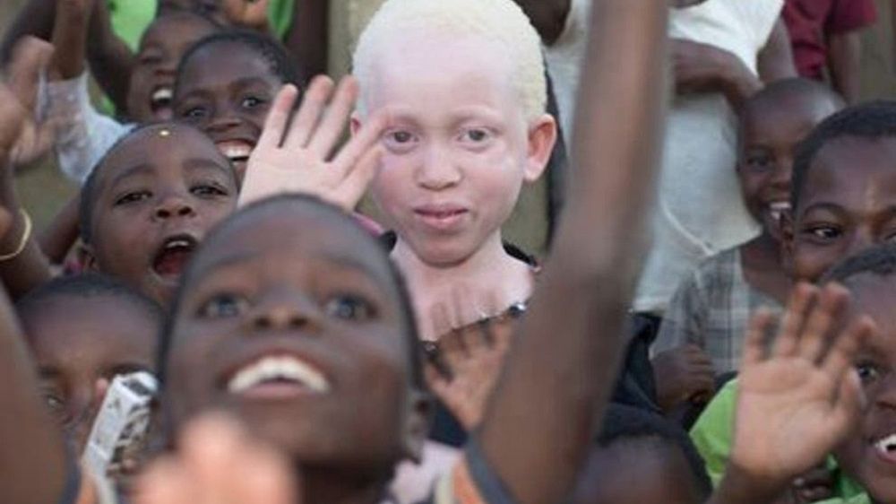 Albinosi mordowani w Afryce