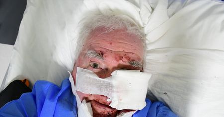 Fotoreporter postrzelony na Marszu Niepodległości. Kontrowersyjna decyzja prokuratury