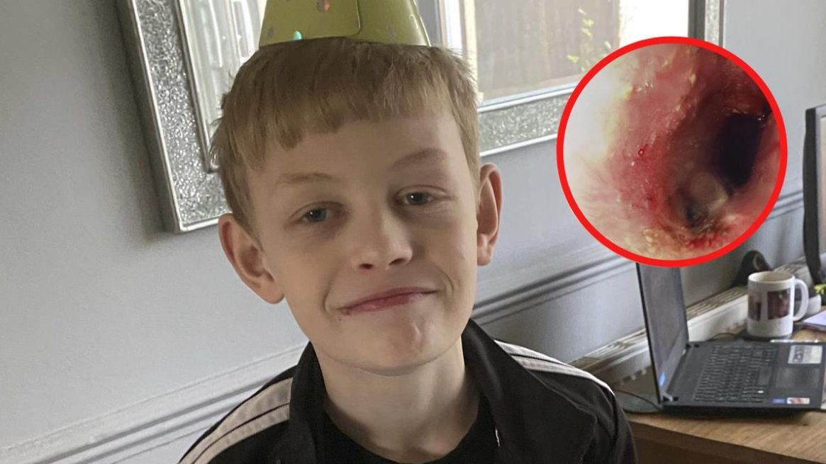 Życie 10-latka było zagrożone