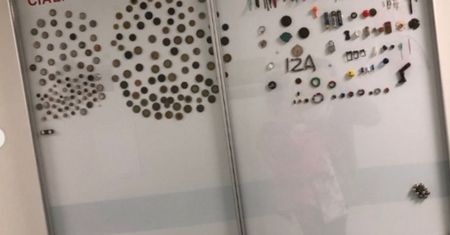 Gablota grozy w szpitalu w Katowicach. Pokazali, jakie przedmioty połknęli mali pacjenci