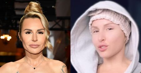 Blanka Lipińska zafundowała sobie "nową twarz". Pokazała się o poranku w wersji saute