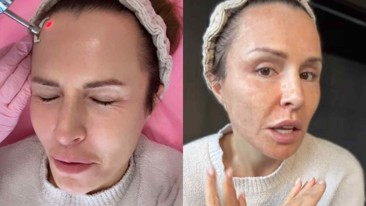 Blanka Lipińska poddała się zabiegowi, ale nie wie jakiemu