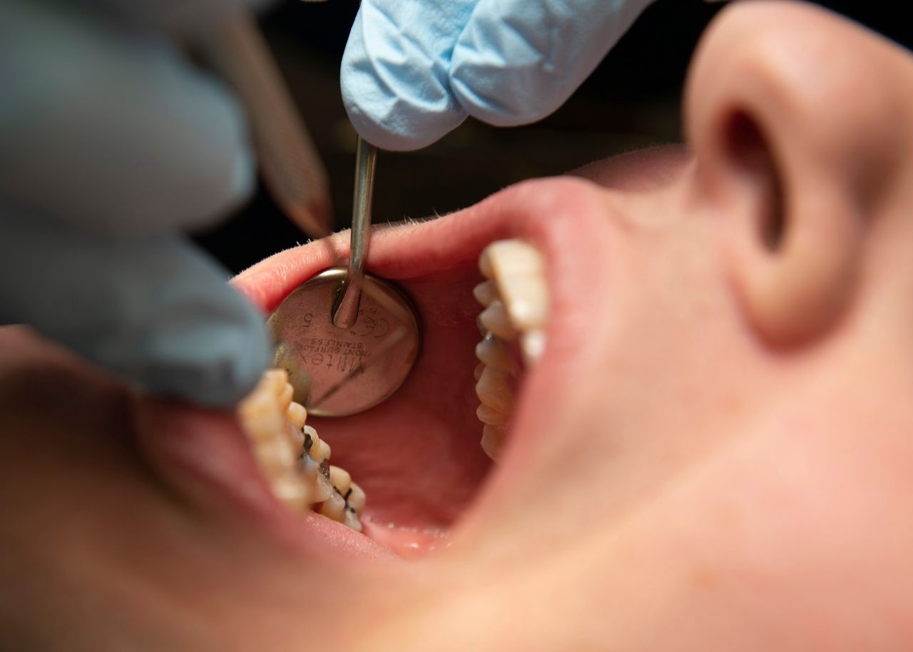 Nowe zasady u dentysty. Tego już nie zrobisz. UE zabroniła