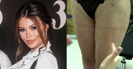 TYLKO NA PUDELKU: Justyna Gradek BRONI "lekarza-partacza"! "Myślenie typu "klient nasz pan" w medycynie się NIE SPRAWDZA"