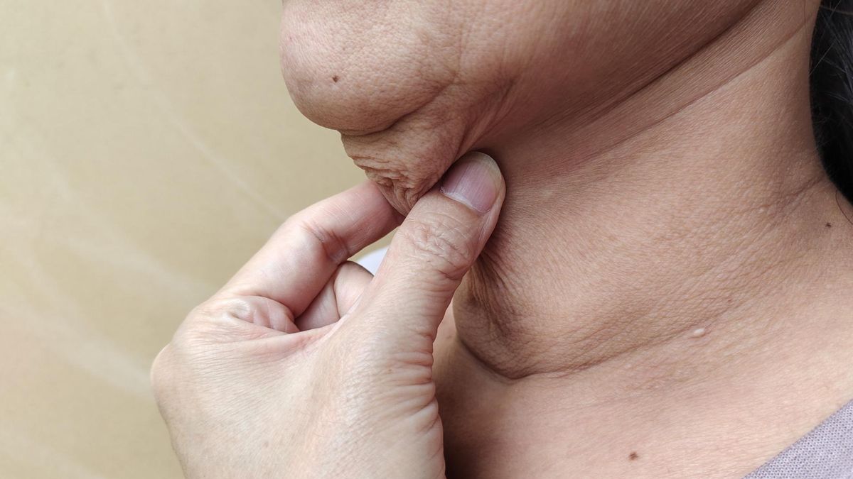 Powiększenie węzłów chłonnych może być jedynym objawem sygnalizującym nowotwór krwi