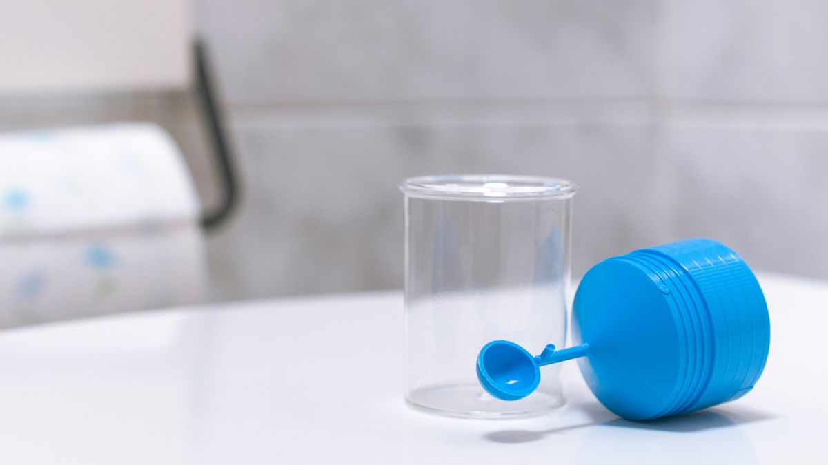 Posiew kału jest badaniem zlecanym m.in. pracownikom służby zdrowia oraz gastronomii