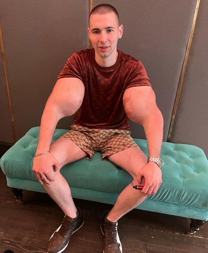 Zawodnik MMA chętnie pokazywał efekty wstrzykiwania niebezpiecznej substancji w mediach społecznościowych