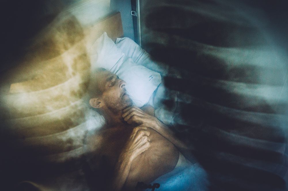 Epidemia gruźlicy na Ukrainie na zdjęciach Maxima Dondyuka