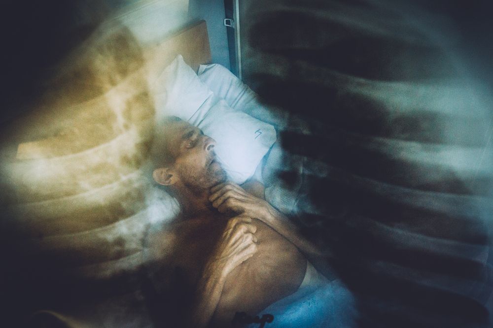 Epidemia gruźlicy na Ukrainie na zdjęciach Maxima Dondyuka 1
