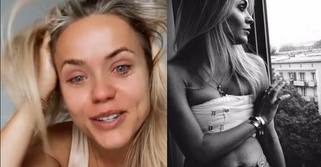 Anna Skura drąży temat aquafillingu i zaznacza: "Mimo tego, co przeszłam, NIE NEGUJĘ operacji plastycznych" (FOTO)